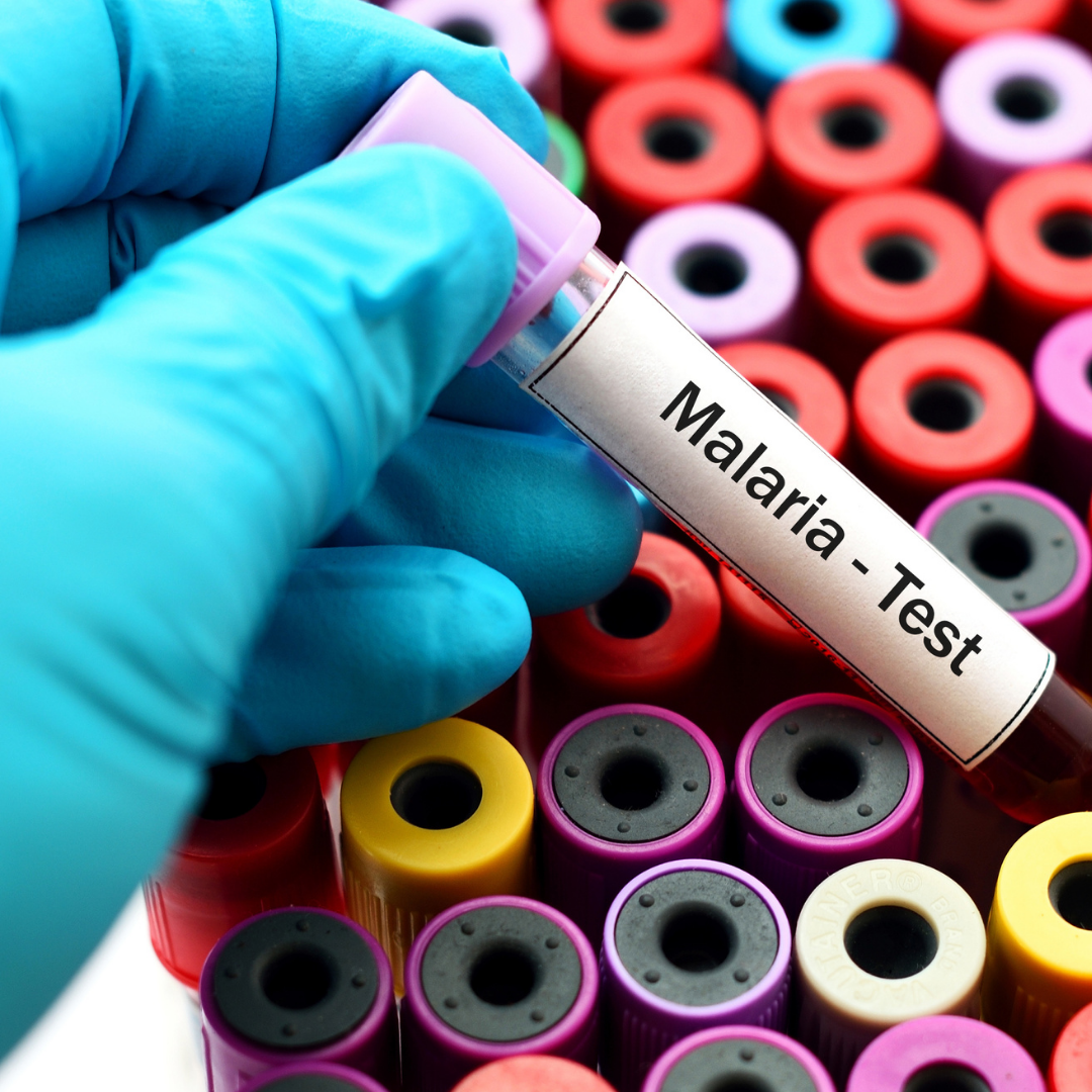 Malaria Testing in Africa